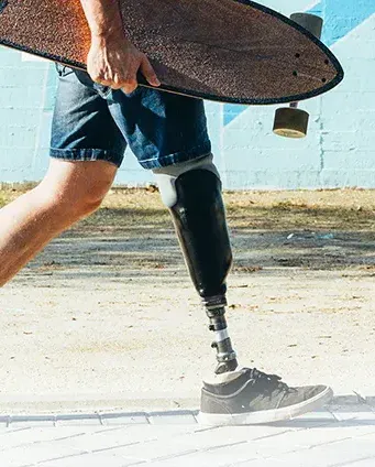 Mann mit Beinprothese, ein Skateboard unter dem Arm